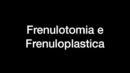 frenulotomia frenuloplstica