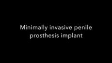 minimally invasive penile prosthesis implant