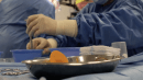 ⚕️Penile Implants Italy. Top European Center, Minimally Invasive Technique Antonini Urology, Rome