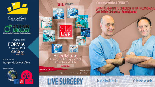 siulive2022