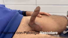 Paziente con patologia vascolare. Attivazione e disattivazione protesi peniena