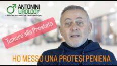 Protesi Pene e Tumore Prostata Testimonianza dopo intervento