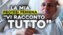 La mia protesi peniena "Vi racconto tutto".