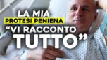 La mia protesi peniena "Vi racconto tutto".
